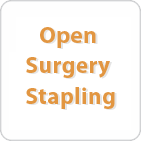 Open Surgery Stapling Expired